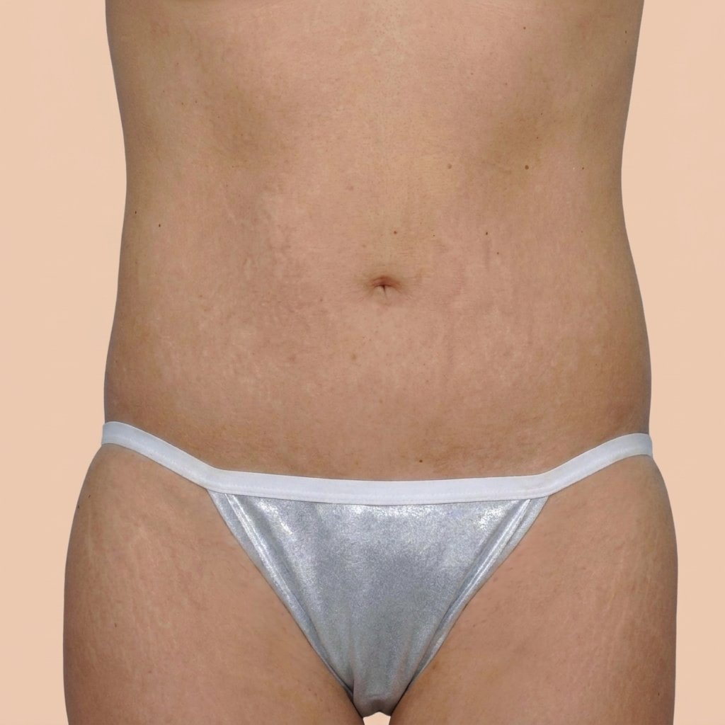 After Image