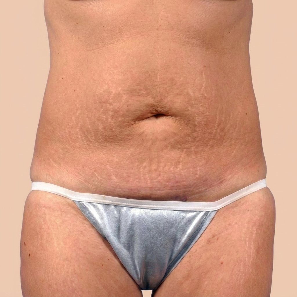 Before Image