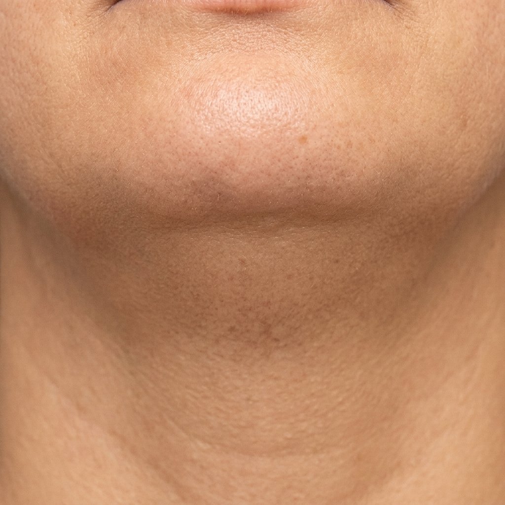 After Image