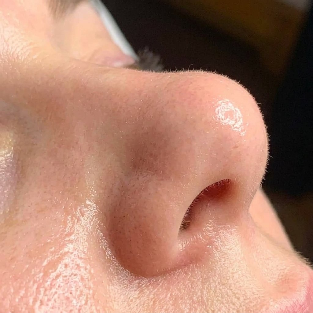After Image