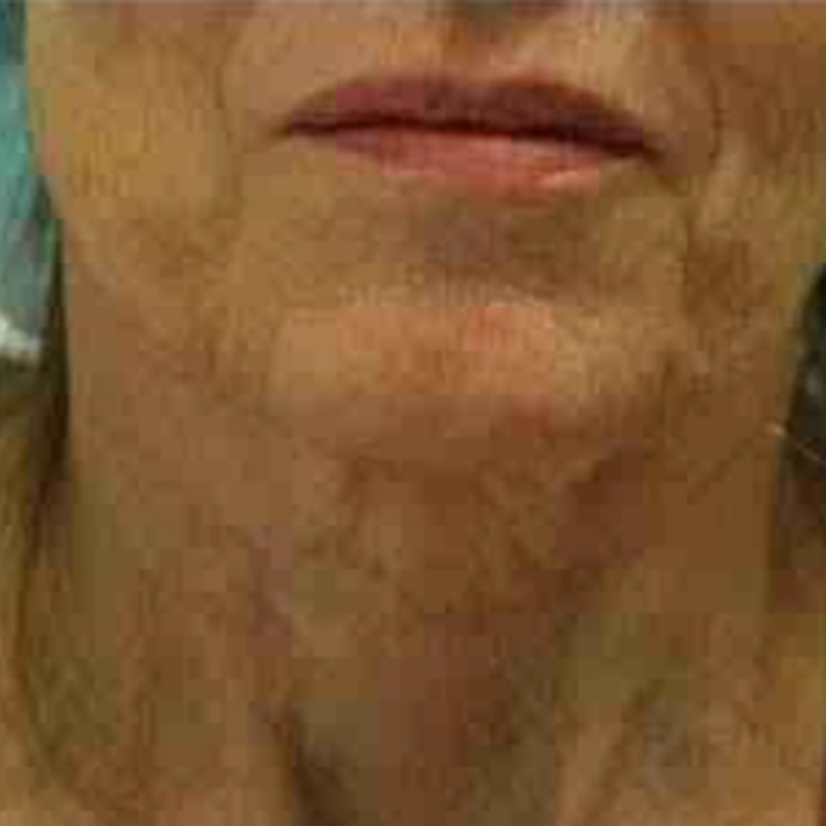 After Image