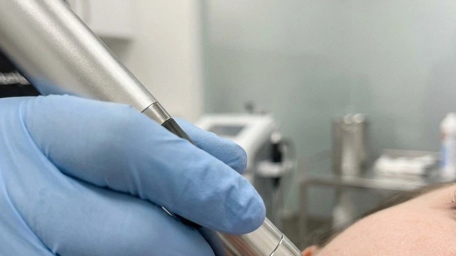 A gloved hand guiding a radiofrequency microneedling handpiece across skin in close detail.
